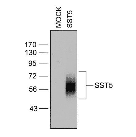 Western blot - Anti-SSTR5 Antibody (A334547) - Antibodies.com