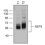 Western blot - Anti-SSTR5 Antibody (A334547) - Antibodies.com