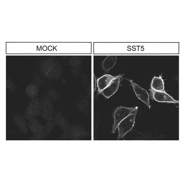 Immunohistochemistry - Anti-SSTR5 Antibody (A334547) - Antibodies.com