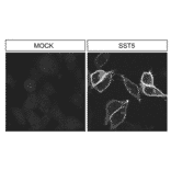 Immunohistochemistry - Anti-SSTR5 Antibody (A334547) - Antibodies.com