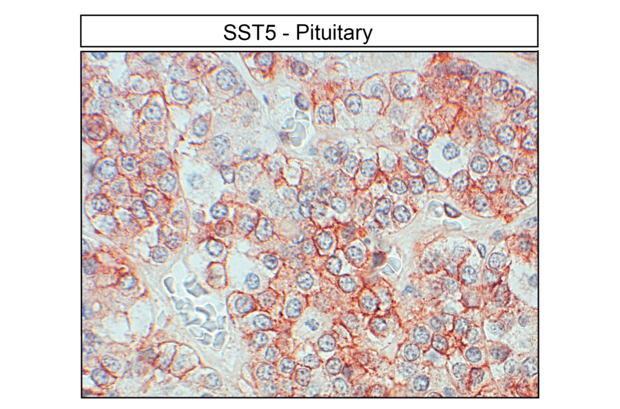 Immunohistochemistry - Anti-SSTR5 Antibody (A334547) - Antibodies.com
