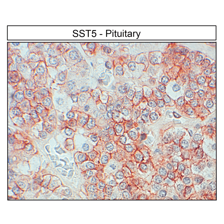 Immunohistochemistry - Anti-SSTR5 Antibody (A334547) - Antibodies.com
