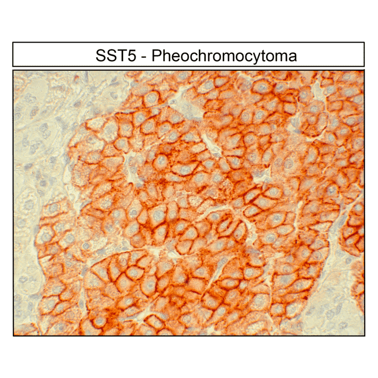 Immunohistochemistry - Anti-SSTR5 Antibody (A334547) - Antibodies.com