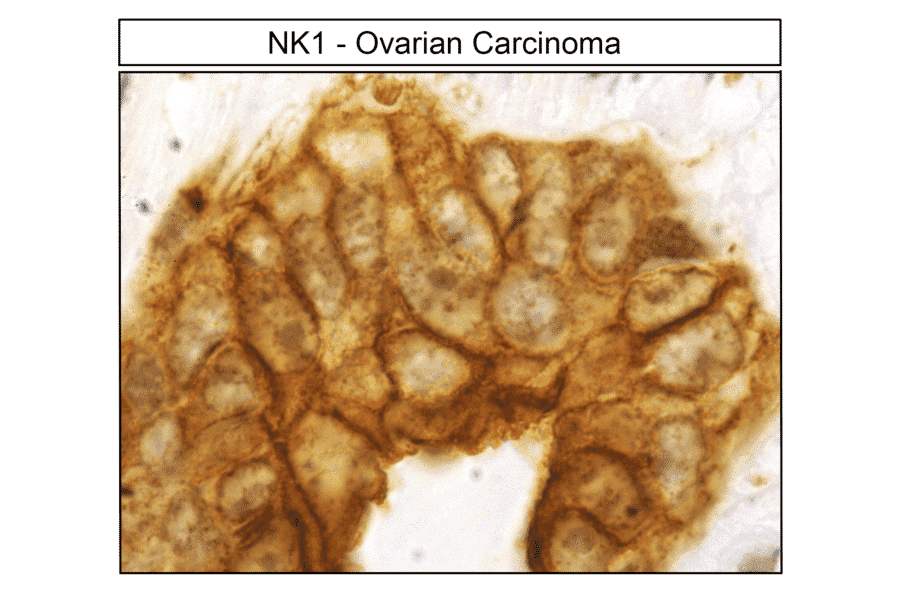 Immunohistochemistry - Anti-NK1R Antibody (A334551) - Antibodies.com