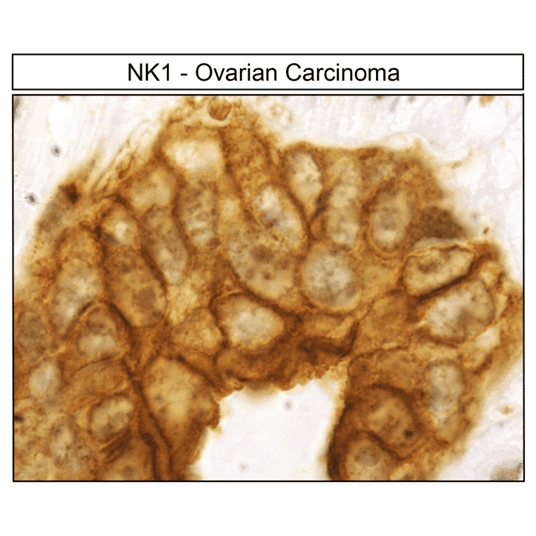 Immunohistochemistry - Anti-NK1R Antibody (A334551) - Antibodies.com
