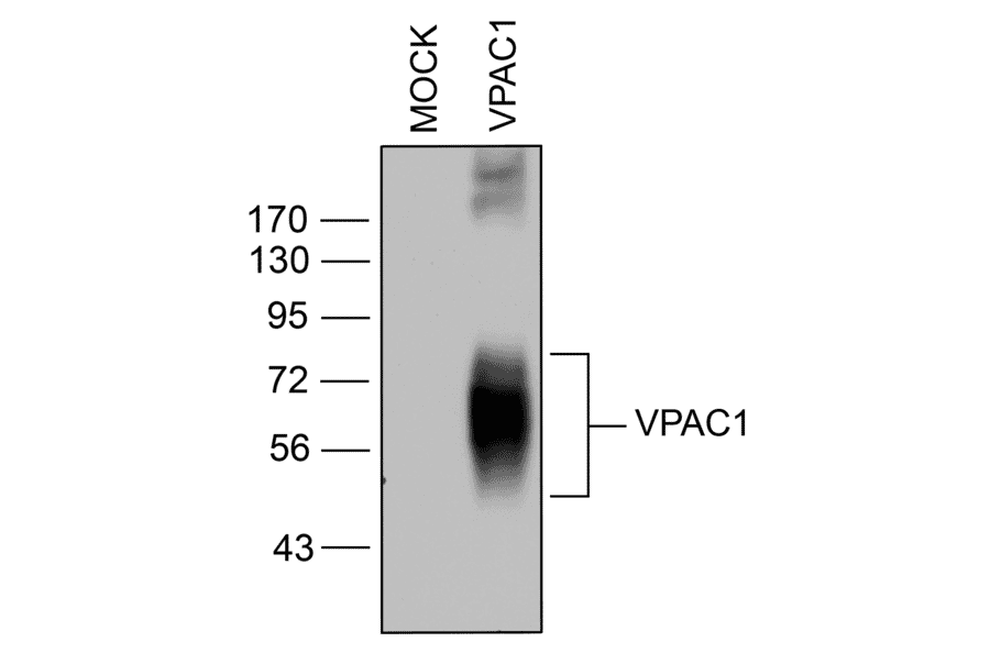 Western blot - Anti-VIP Receptor 1 Antibody (A334554) - Antibodies.com