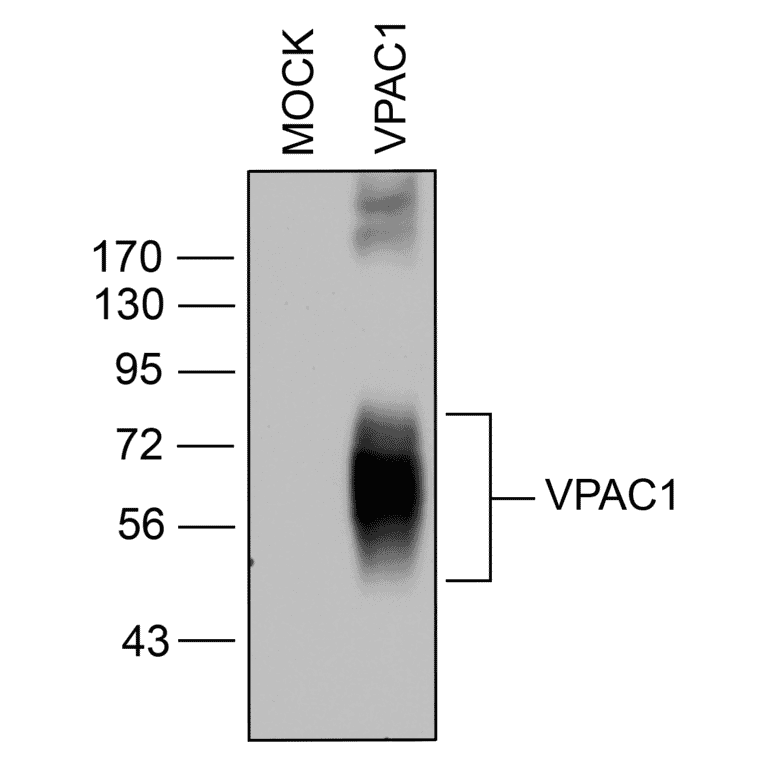 Western blot - Anti-VIP Receptor 1 Antibody (A334554) - Antibodies.com