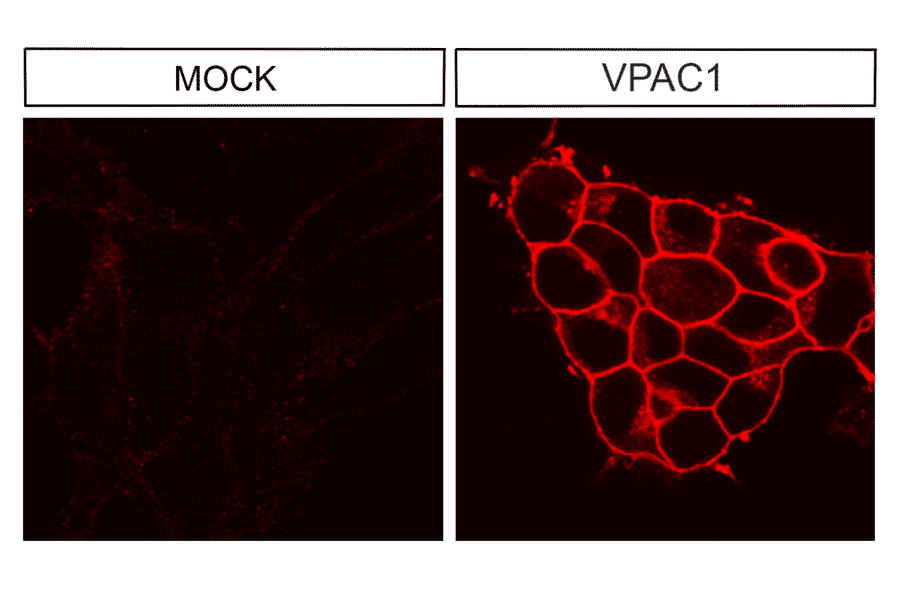 Immunohistochemistry - Anti-VIP Receptor 1 Antibody (A334554) - Antibodies.com