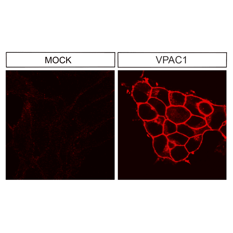 Immunohistochemistry - Anti-VIP Receptor 1 Antibody (A334554) - Antibodies.com