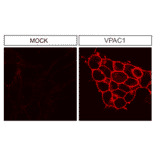 Immunohistochemistry - Anti-VIP Receptor 1 Antibody (A334554) - Antibodies.com