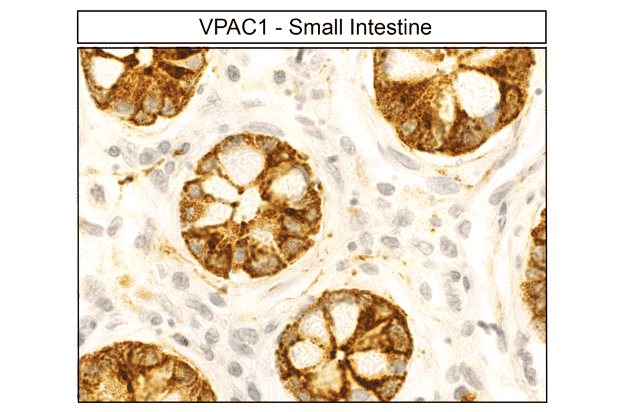 Immunohistochemistry - Anti-VIP Receptor 1 Antibody (A334554) - Antibodies.com