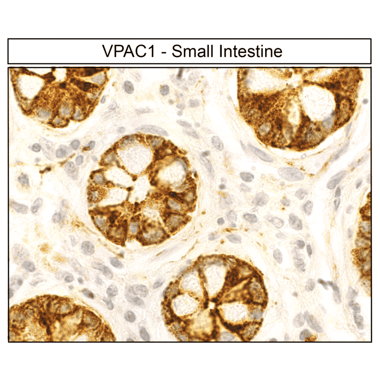 Immunohistochemistry - Anti-VIP Receptor 1 Antibody (A334554) - Antibodies.com