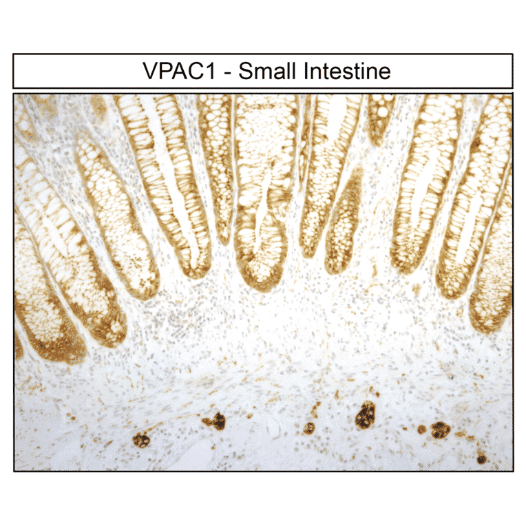 Immunohistochemistry - Anti-VIP Receptor 1 Antibody (A334554) - Antibodies.com