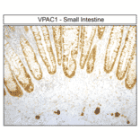 Immunohistochemistry - Anti-VIP Receptor 1 Antibody (A334554) - Antibodies.com