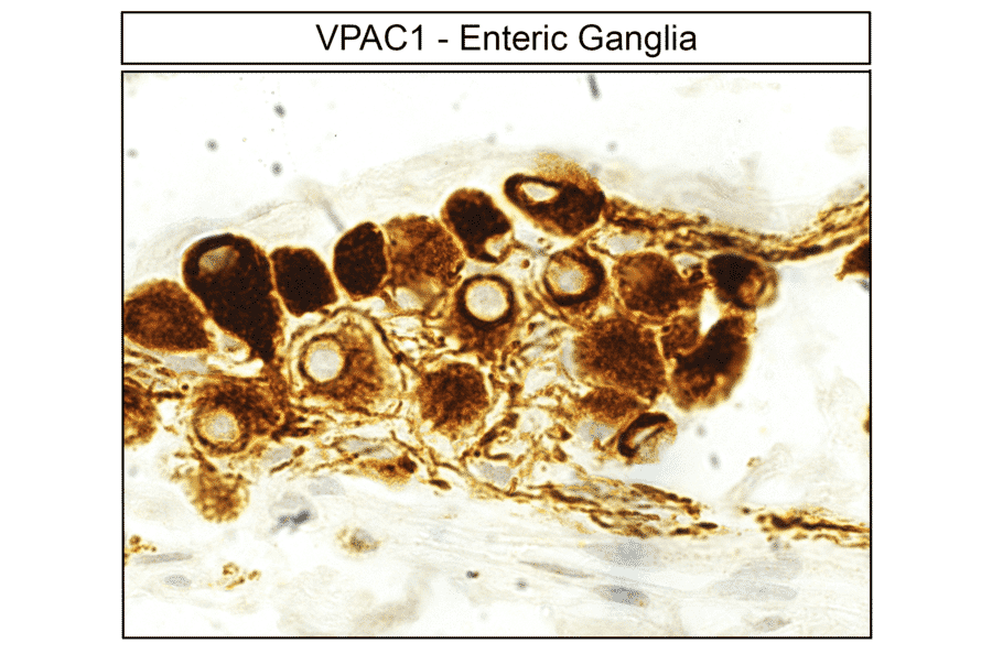 Immunohistochemistry - Anti-VIP Receptor 1 Antibody (A334554) - Antibodies.com