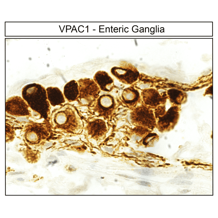 Immunohistochemistry - Anti-VIP Receptor 1 Antibody (A334554) - Antibodies.com