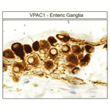 Immunohistochemistry - Anti-VIP Receptor 1 Antibody (A334554) - Antibodies.com