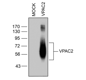Western blot - Anti-VPAC2 Antibody (A334555) - Antibodies.com