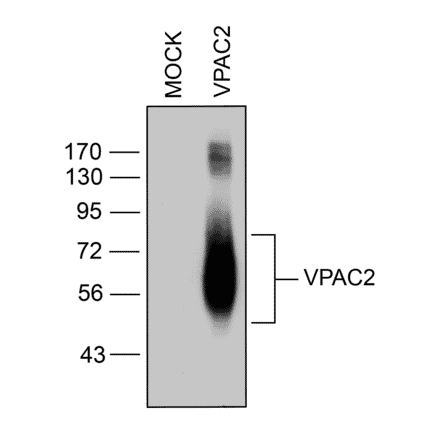 Western blot - Anti-VPAC2 Antibody (A334555) - Antibodies.com
