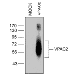 Western blot - Anti-VPAC2 Antibody (A334555) - Antibodies.com