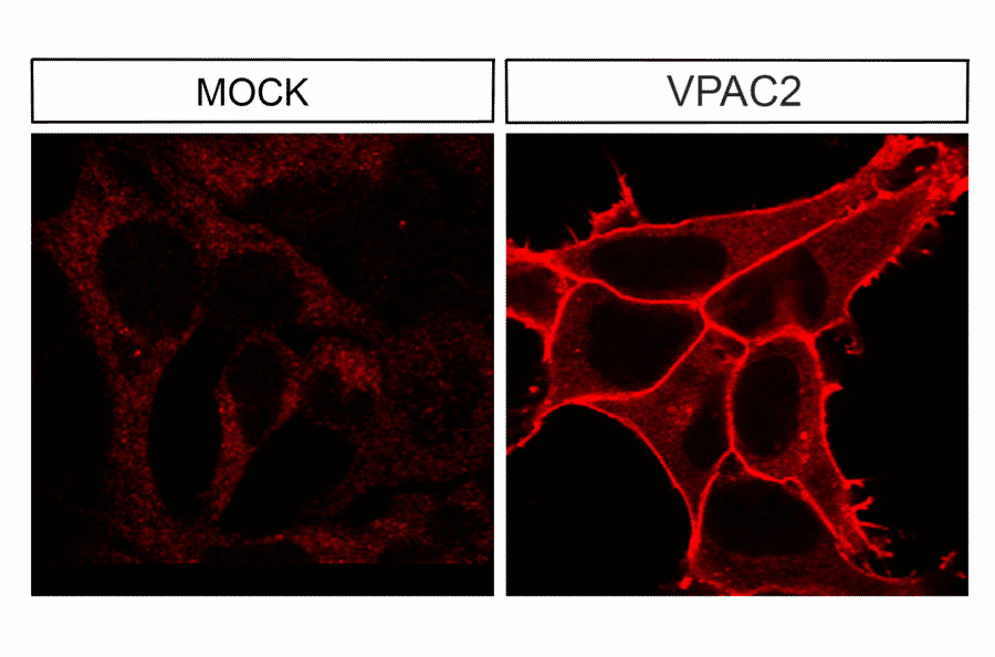 Immunohistochemistry - Anti-VPAC2 Antibody (A334555) - Antibodies.com