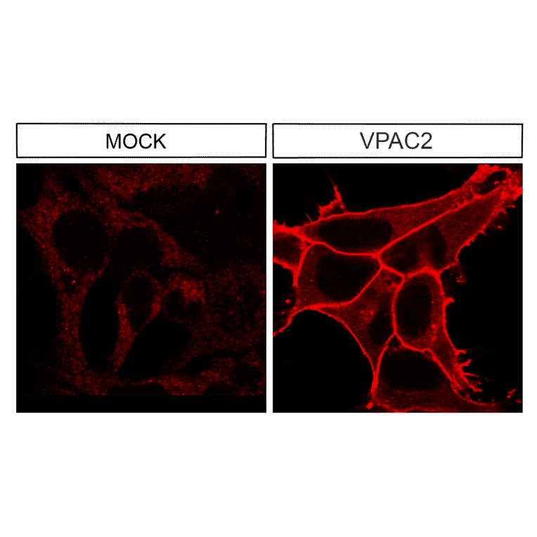 Immunohistochemistry - Anti-VPAC2 Antibody (A334555) - Antibodies.com