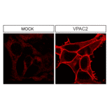 Immunohistochemistry - Anti-VPAC2 Antibody (A334555) - Antibodies.com