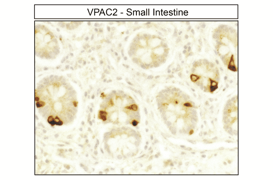 Immunohistochemistry - Anti-VPAC2 Antibody (A334555) - Antibodies.com
