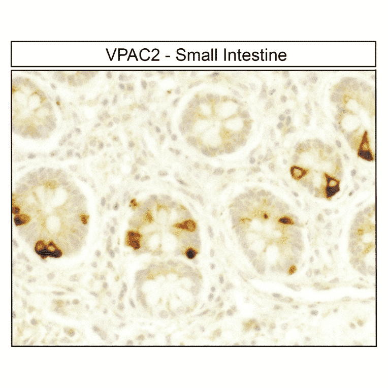 Immunohistochemistry - Anti-VPAC2 Antibody (A334555) - Antibodies.com