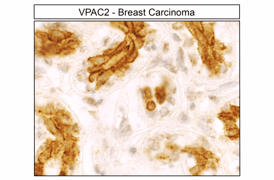 Immunohistochemistry - Anti-VPAC2 Antibody (A334555) - Antibodies.com