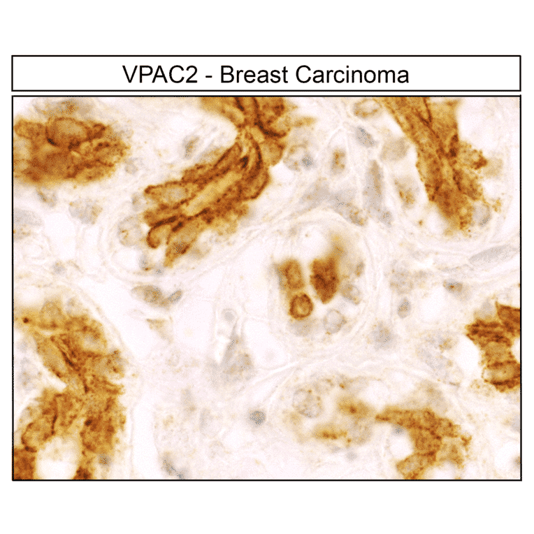 Immunohistochemistry - Anti-VPAC2 Antibody (A334555) - Antibodies.com