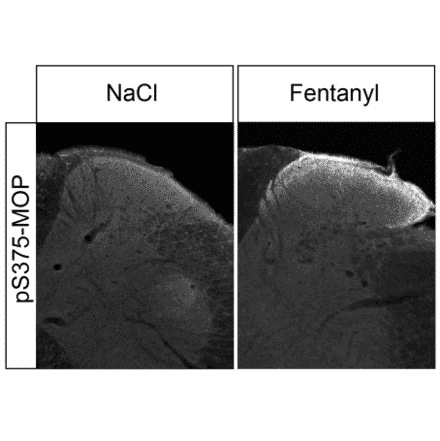 Immunohistochemistry - Anti-Mu Opioid Receptor (phospho Ser375) Antibody (A334558) - Antibodies.com