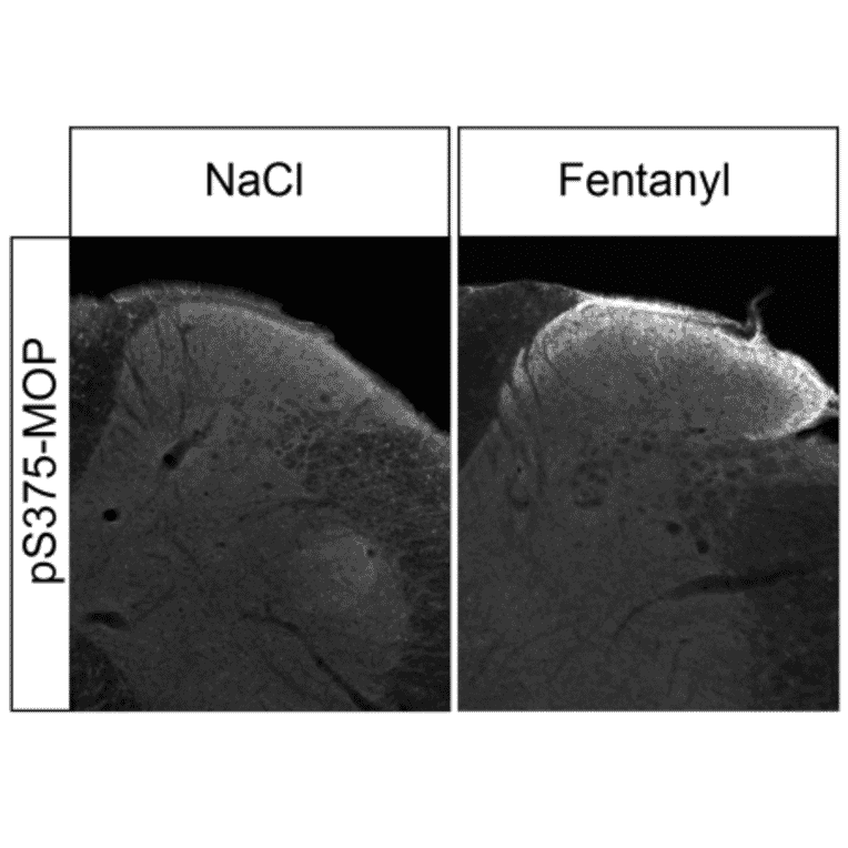 Immunohistochemistry - Anti-Mu Opioid Receptor (phospho Ser375) Antibody (A334558) - Antibodies.com