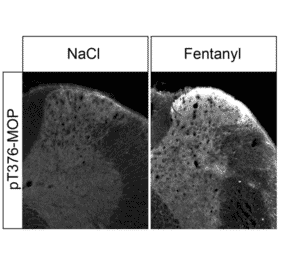 Western blot - Anti-Mu Opioid Receptor (phoshpo Thr376) Antibody (A334559) - Antibodies.com