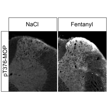 Western blot - Anti-Mu Opioid Receptor (phoshpo Thr376) Antibody (A334559) - Antibodies.com