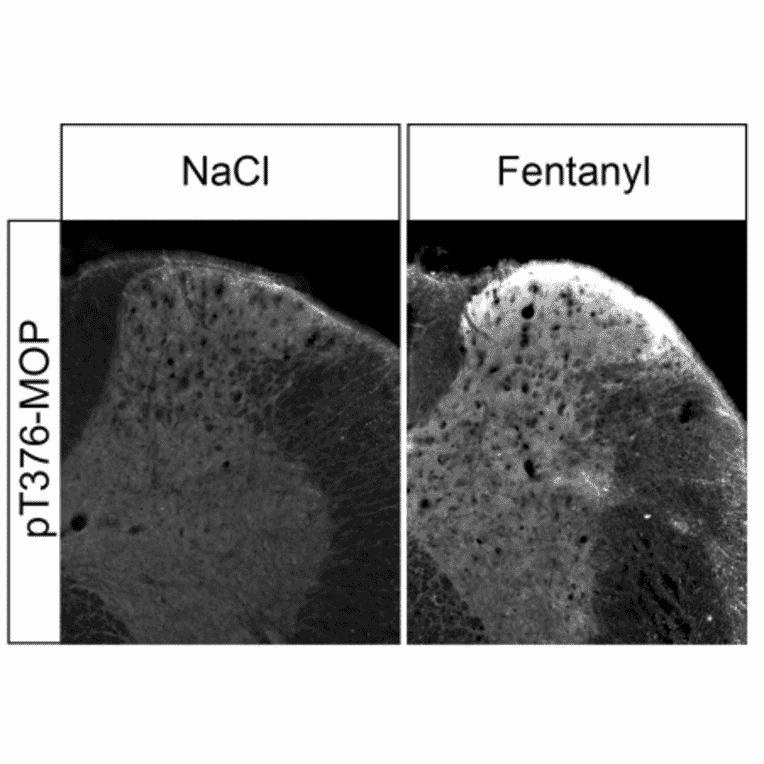 Western blot - Anti-Mu Opioid Receptor (phoshpo Thr376) Antibody (A334559) - Antibodies.com