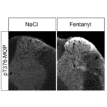 Western blot - Anti-Mu Opioid Receptor (phoshpo Thr376) Antibody (A334559) - Antibodies.com