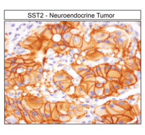 Immunohistochemistry - Anti-SSTR2 Antibody (A334560) - Antibodies.com