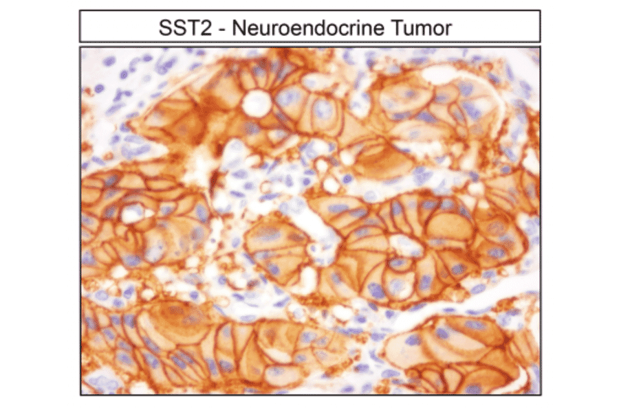 Immunohistochemistry - Anti-SSTR2 Antibody (A334560) - Antibodies.com