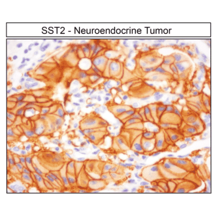 Immunohistochemistry - Anti-SSTR2 Antibody (A334560) - Antibodies.com