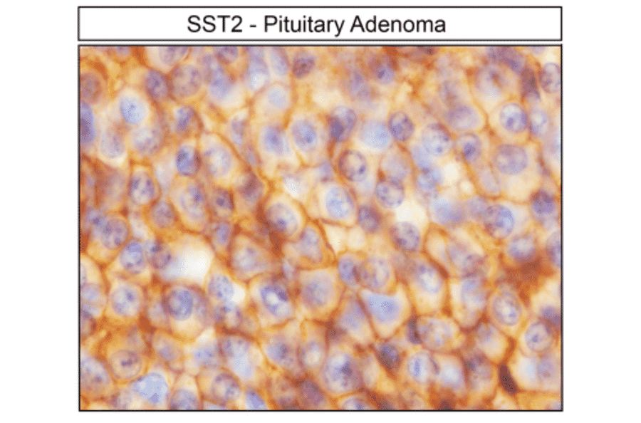 Immunohistochemistry - Anti-SSTR2 Antibody (A334560) - Antibodies.com