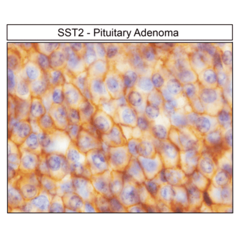 Immunohistochemistry - Anti-SSTR2 Antibody (A334560) - Antibodies.com