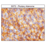 Immunohistochemistry - Anti-SSTR2 Antibody (A334560) - Antibodies.com