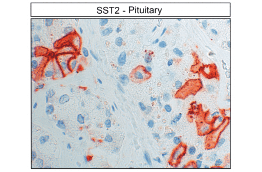Immunohistochemistry - Anti-SSTR2 Antibody (A334560) - Antibodies.com