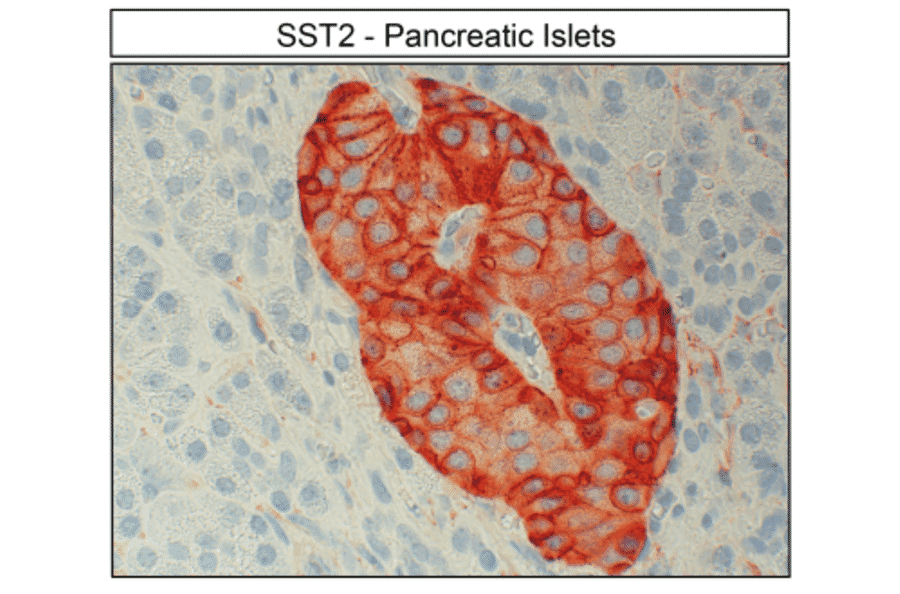 Immunohistochemistry - Anti-SSTR2 Antibody (A334560) - Antibodies.com