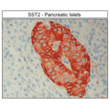 Immunohistochemistry - Anti-SSTR2 Antibody (A334560) - Antibodies.com