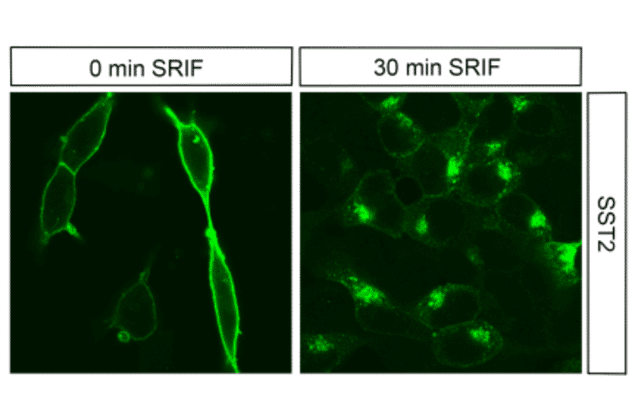 Immunohistochemistry - Anti-SSTR2 Antibody (A334560) - Antibodies.com