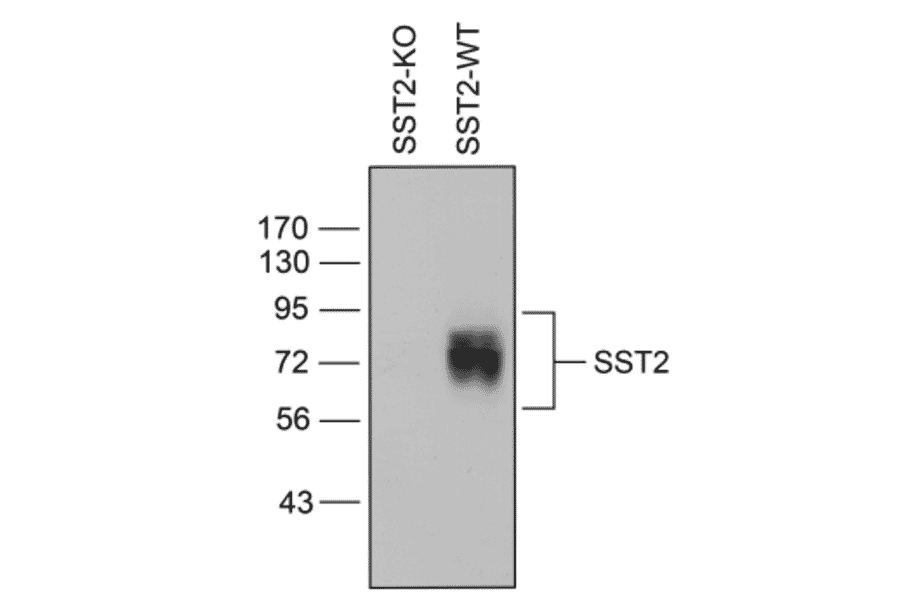 Western blot - Anti-SSTR2 Antibody (A334560) - Antibodies.com