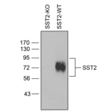 Western blot - Anti-SSTR2 Antibody (A334560) - Antibodies.com