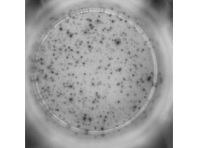 ELISpot - Human IFN gamma ELISpot Kit (A334653) - Antibodies.com